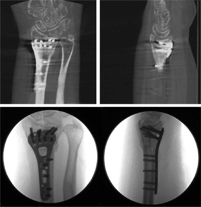 Fig. 2f