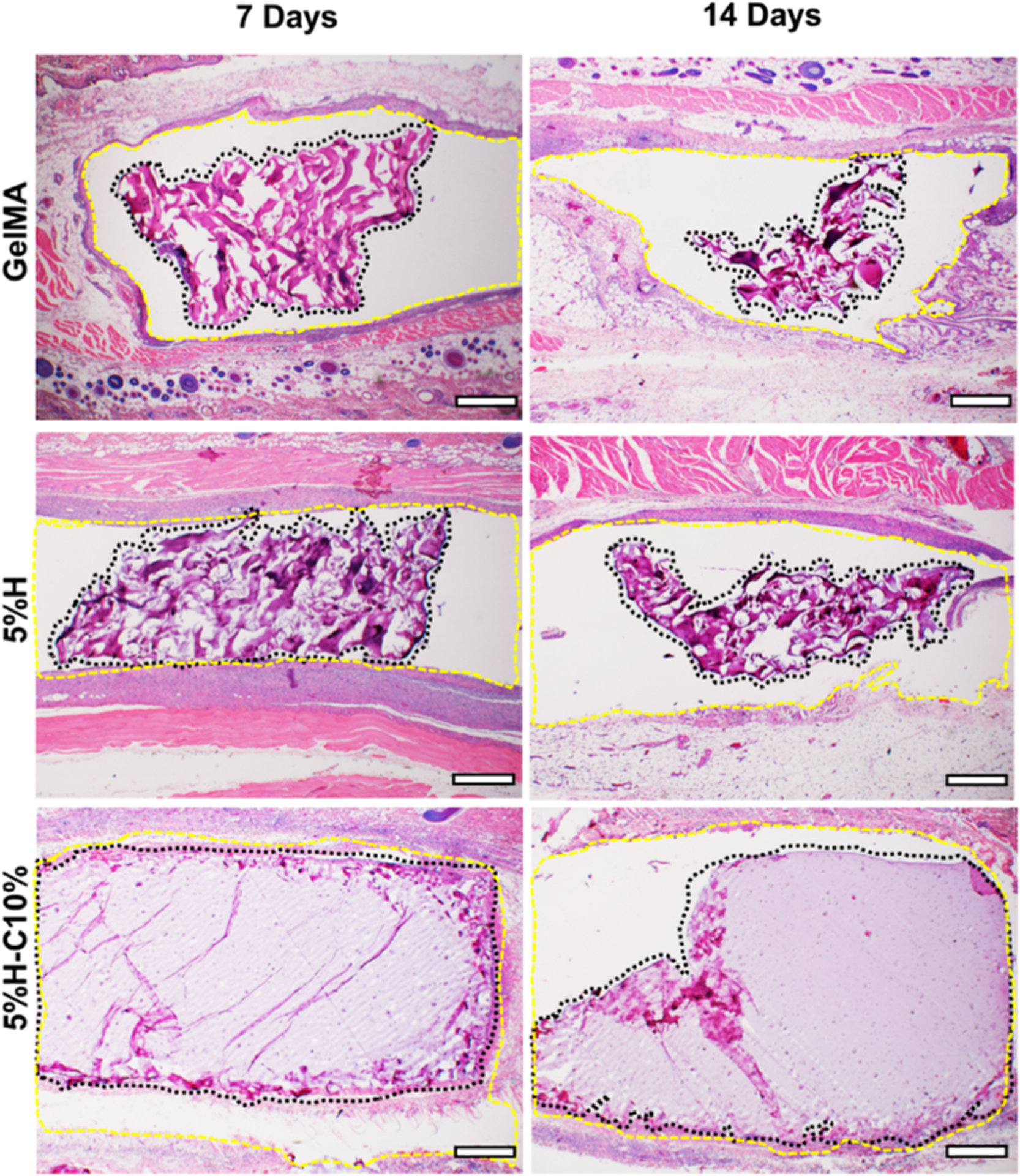 Figure 11.