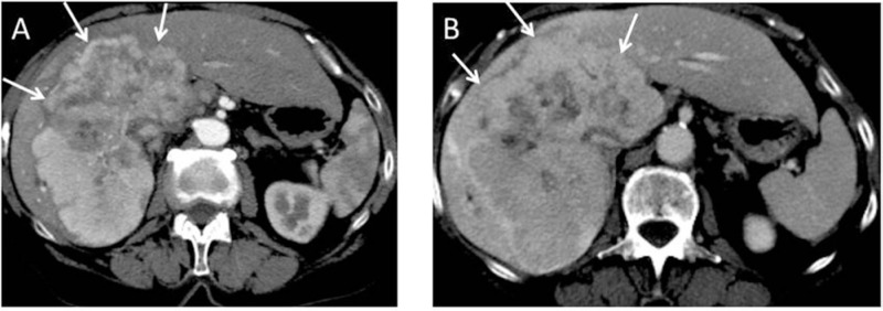 Figure 4: