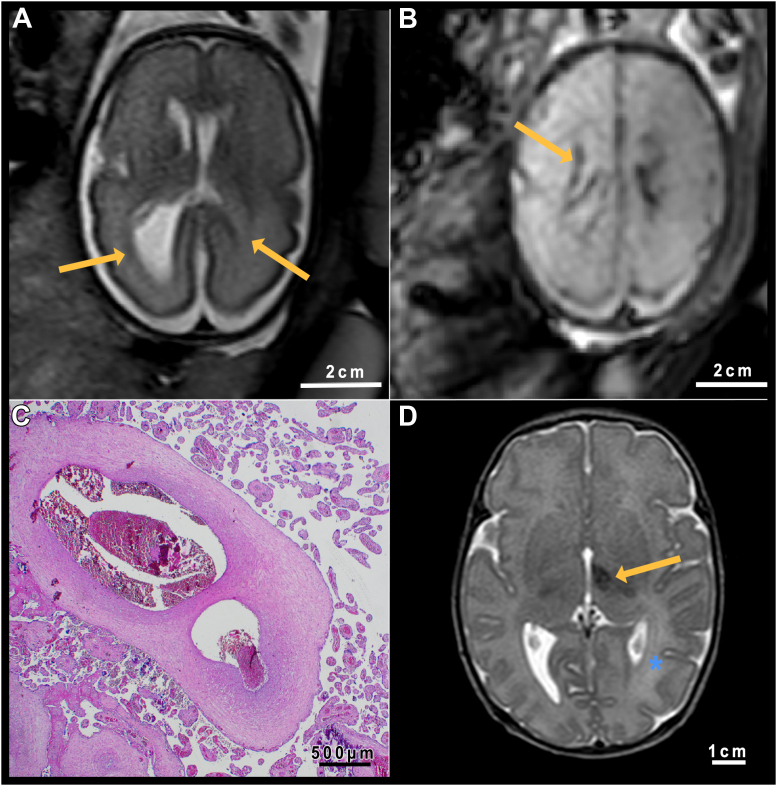 Fig. 3