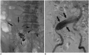 Fig. 15