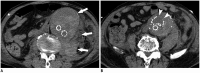 Fig. 16