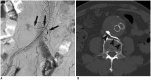 Fig. 14