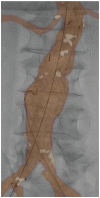 Fig. 20