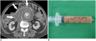 Fig. 18