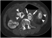 Fig. 19