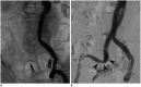 Fig. 17