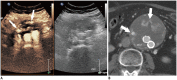 Fig. 21