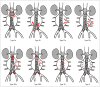 Fig. 12