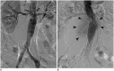 Fig. 11