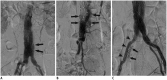 Fig. 13