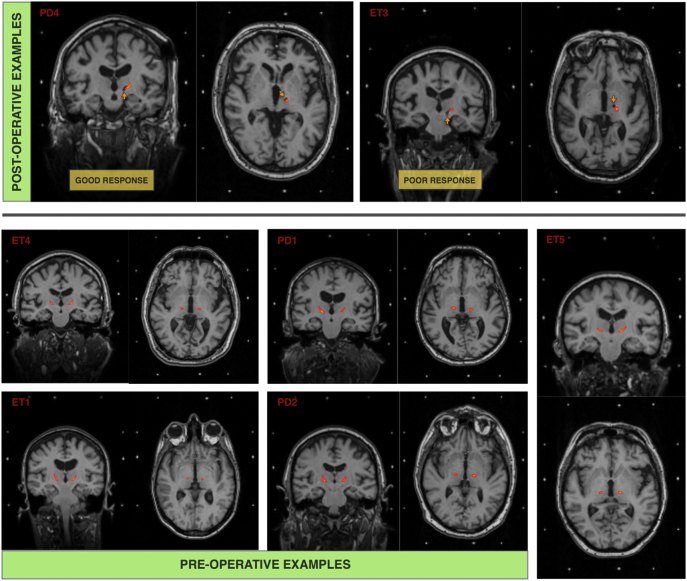 Fig. 4