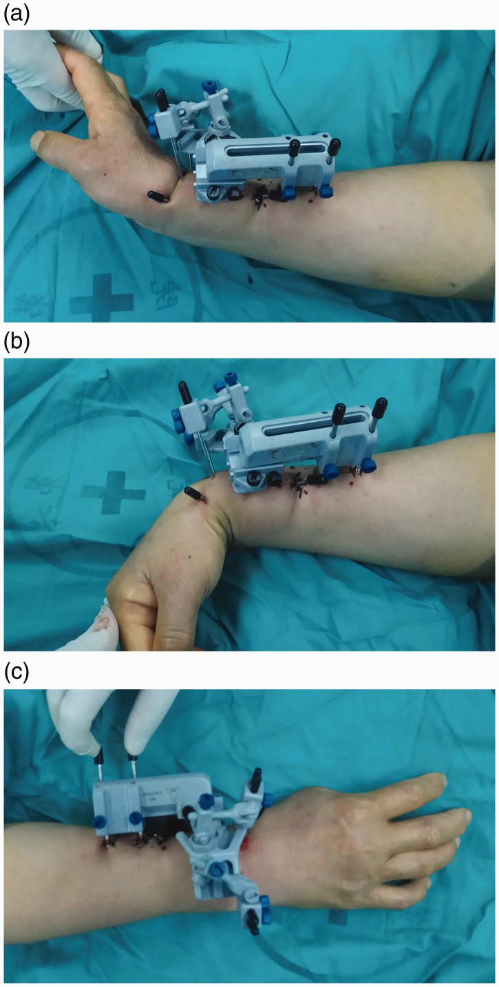 Figure 2.