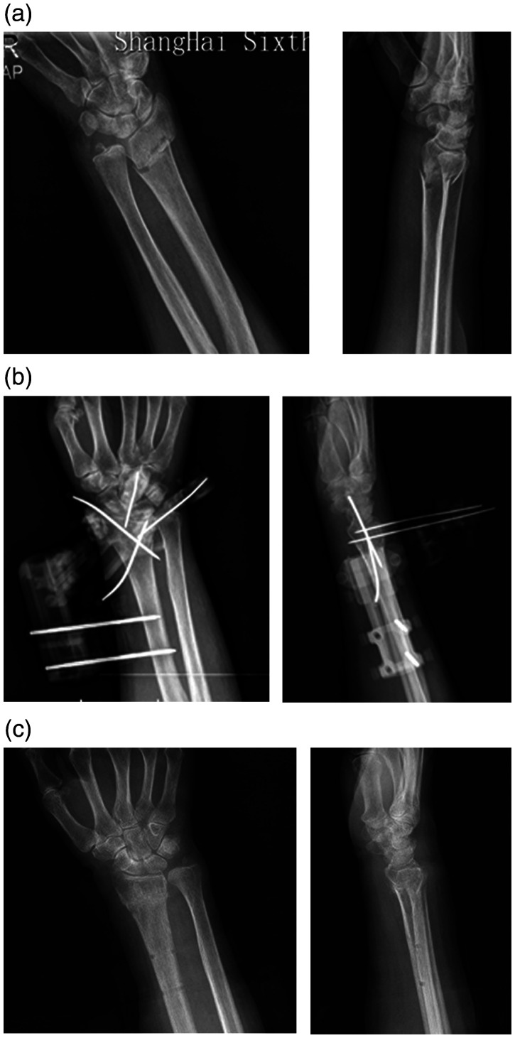 Figure 3.