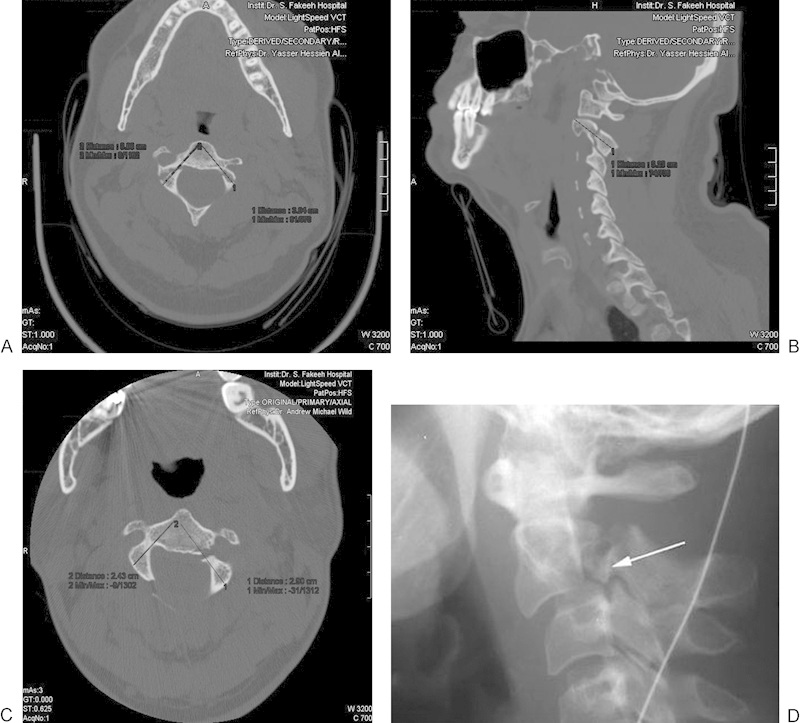 Fig. 2