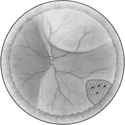 FIGURE 3B