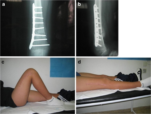 Fig. 3