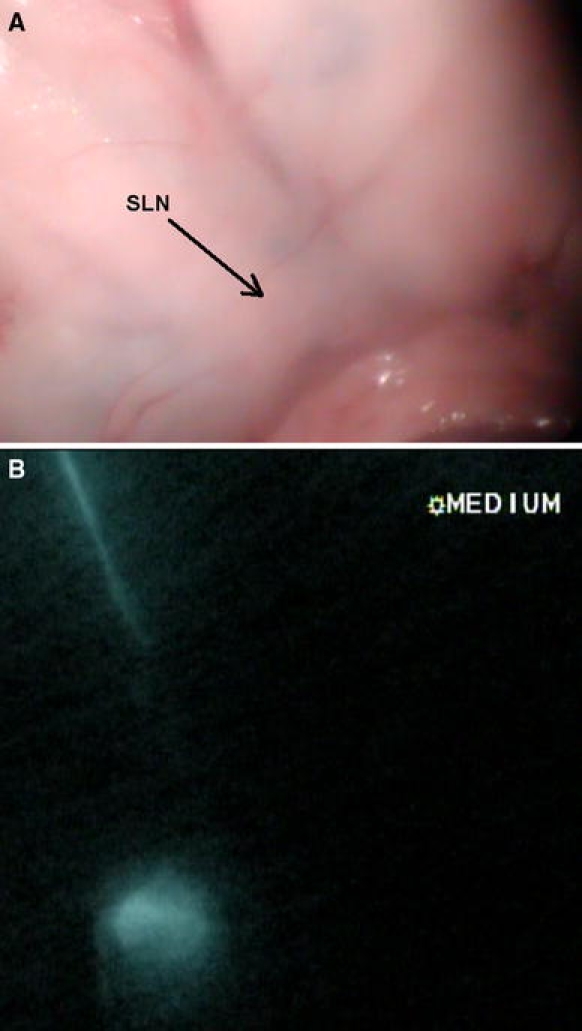 Fig. 2