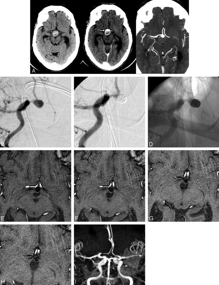 Fig 2.