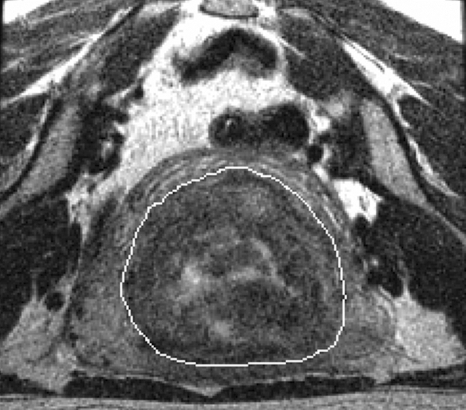 Figure 2a: