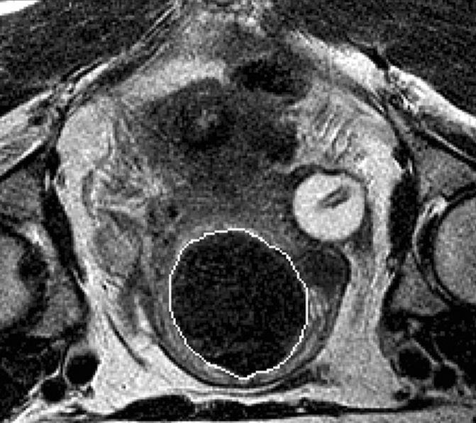 Figure 1a: