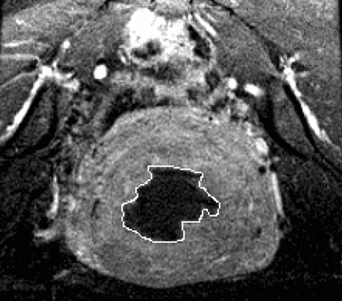 Figure 2b: