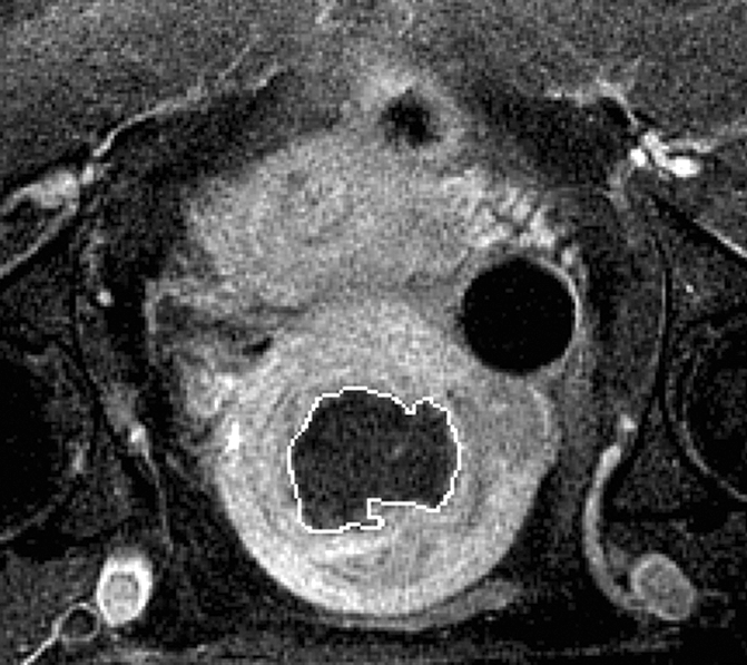 Figure 1b: