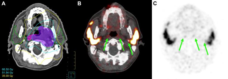 Fig. 3