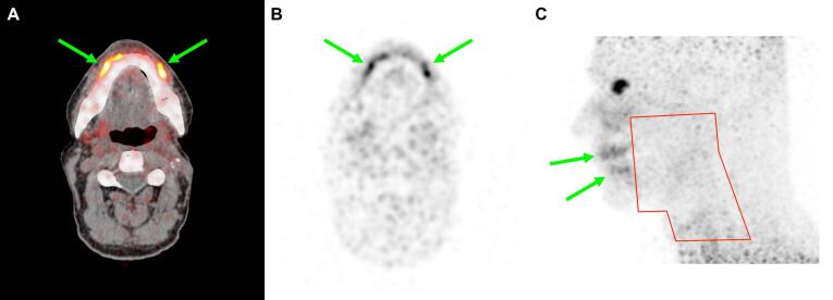 Fig. 4