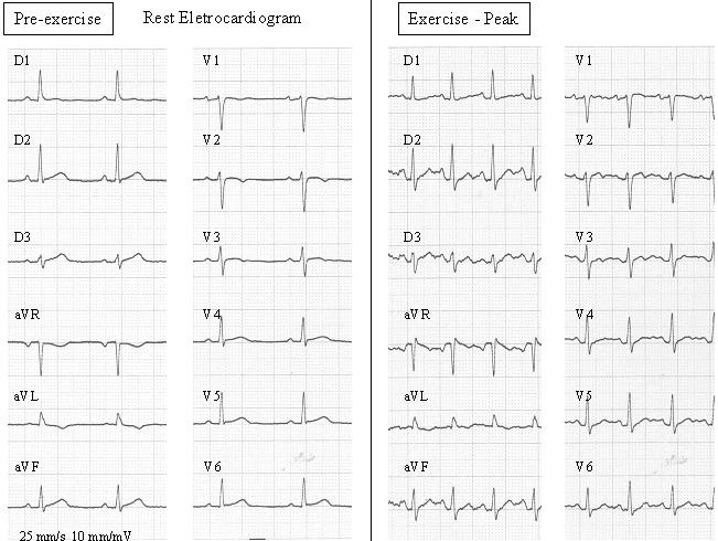 Figure 2B