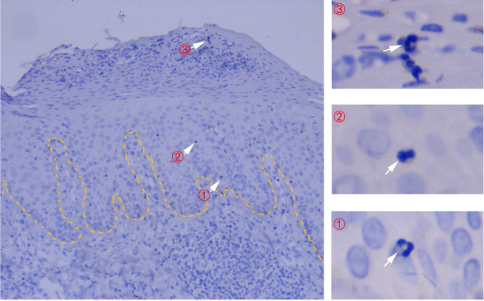 Fig. 1