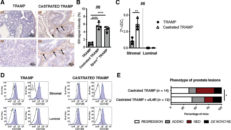 Figure 3. Blocking IL6R inhibits NED in castrated TRAMP mice. A, Representative pictures showing Il6 evaluation by RNAscope on prostate tissues of TRAMP and castrated TRAMP mice. Black arrows, positive cells. Top, magnification, ×200; bottom, magnification, ×400 of the same areas. B, Quantification of staining in A and in Supplementary Fig. S6D. Histogram depicts mean ± SD of biological replicates (represented by dots; n = 4/group). ANOVA followed by Tukey test: ****, P < 0.0001. C, Real-time PCR for Il6 on stromal and luminal cells sorted from the prostates of untreated and castrated TRAMP mice. Histogram depicts mean ± SD of biological replicates (represented by dots; n = 3/group). ANOVA followed by Tukey test: **, P < 0.01. D, Flow cytometry evaluation of IL6R (CD126) and CD130 on stromal and luminal cells in prostates of TRAMP and castrated TRAMP mice. E, Relative percentage of prostatic lesions, scored as in Fig. 1, in 30 weeks old TRAMP mice subjected to surgical castration at 20 weeks of age and left untreated (n = 14; the same cohort reported in Fig. 1A) or treated weekly with αIL6R (n = 12). Fisher test: *, P < 0.05.