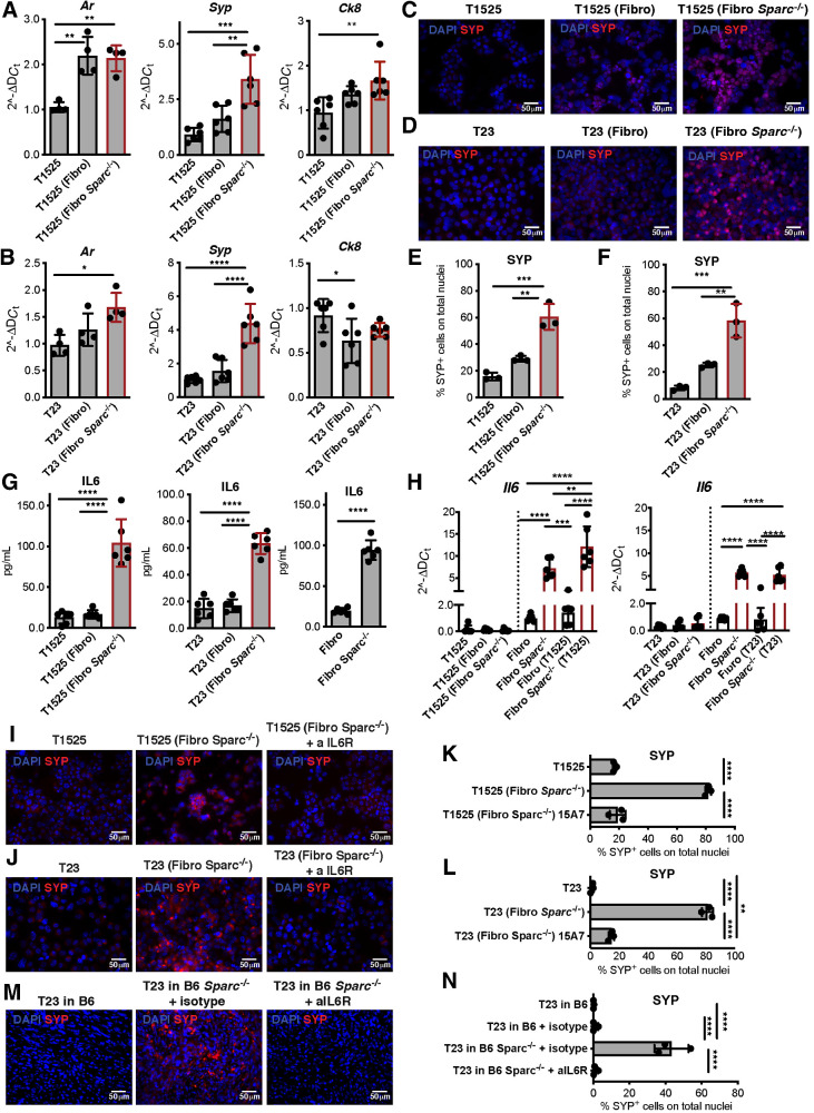 Figure 2. SPARC-deficient fibroblasts mediate NED of adenocarcinoma cells via IL6. A–H, T1525 or T23 prostate adenocarcinoma cell lines were cocultured with wild-type (Fibro) or SPARC-deficient (Fibro Sparc−/−) fibroblasts. Cells were divided by a 0.4-μm pore transwell and analyzed after 7 days of culture. A and B, Real-time PCR for Ar, Syp, and Ck8 on tumor cells. C and D, Representative immunofluorescence for SYP (red) on tumor cells. Blue, DAPI. E and F, Quantification of immunofluorescence in C and D. G, ELISA for IL6 on cell culture supernatants. H, Real-time PCR for Il6 on tumor cells (black bars) or fibroblasts (white bars). A–H, Data are a pool of three independent experiments. Legends indicate the cell type plated on the bottom of the well, and further analyzed, and the cell type plated in the transwell insert is reported in the parentheses. I and J, T1525 (I) or T23 (J) cells were cultured as in A with Sparc−/− fibroblasts, in presence or not of anti-IL6 receptor antibody (αIL6R). SYP (red) was analyzed by immunofluorescence. Blue, DAPI. Experiment was repeated three times. K, Quantification of immunofluorescence in I. L, Quantification of immunofluorescence in L. M, Representative immunofluorescence (red, SYP; blue, DAPI) of T23-derived tumors grown in wild-type (B6) or Sparc−/− mice, treated or not with αIL6R or isotype control as indicated. Experiment was repeated two times, each with three mice/group, with comparable results. One of the two experiments is shown. N, Quantification of immunofluorescence in M. All histograms depict mean ± SD of biological replicates (represented by dots). One-way ANOVA followed by Tukey test: *, P < 0.05; **, P < 0.01; ***, P < 0.001; ****, P < 0.0001.