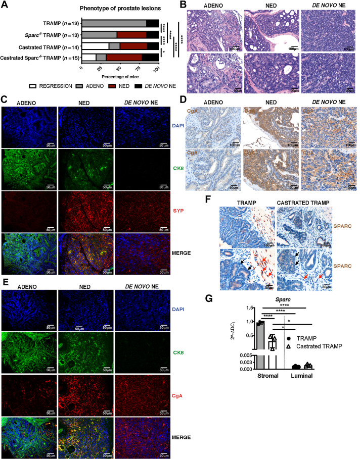 Figure 1. NED similarly occurs in SPARC-deficient or castrated TRAMP mice. A, Percentage of prostatic lesions scored as adenocarcinoma (ADENO), neuroendocrine differentiation (NED), de novo neuroendocrine (NE), or regression in 30-week-old TRAMP (n = 13), Sparc−/− TRAMP mice (n = 13), TRAMP mice subjected to surgical castration (n = 14), and Sparc−/− TRAMP mice subjected to surgical castration (n = 15). Fisher test: ****, P < 0.0001; *, P < 0.05. B–E, Representative images of prostates of mice affected by adenocarcinoma, NED, or de novo NE. Hematoxylin and eosin (B); immunofluorescence staining for CK8 (green), SYP (red) and DAPI (blue; C); IHC for CgA (D); immunofluorescence staining for CK8 (green), CgA (red), and DAPI (blue; E). F, Representative IHC for SPARC in prostates of TRAMP and castrated TRAMP mice. Red and black arrows highlight stromal and tumor cells, respectively. G, Real-time PCR for Sparc on stromal and luminal cells sorted from the prostates of untreated and castrated TRAMP mice. Histograms depict mean ± SD of biological replicates (indicated by dots, n = 3/group). One-way ANOVA followed by Tukey test: **, P < 0.01. B, D, and F, Top, magnification ×200; bottom, magnification ×400 of the same areas.