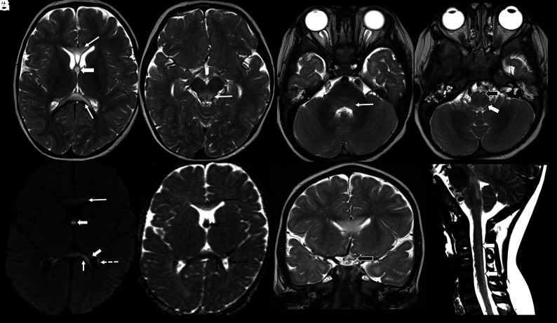 FIG 3.