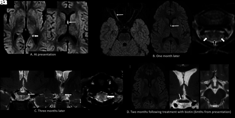 FIG 4.