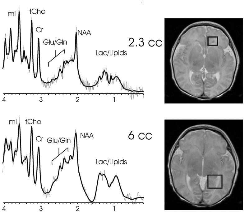 Fig. 10