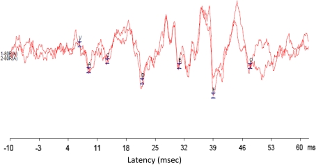 Fig. 2