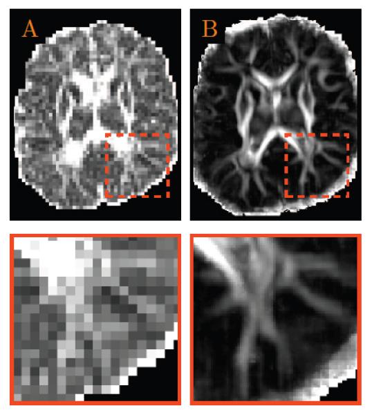 Figure 13