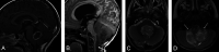 FIG 2.