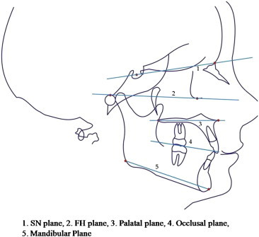 Fig. 2