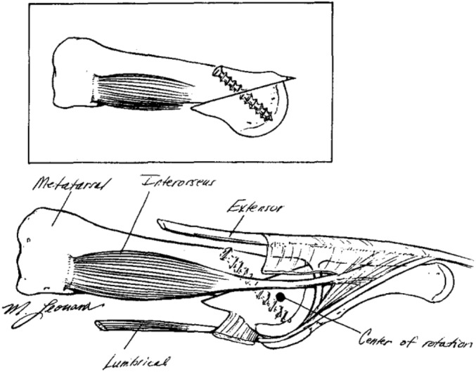 FIGURE 4