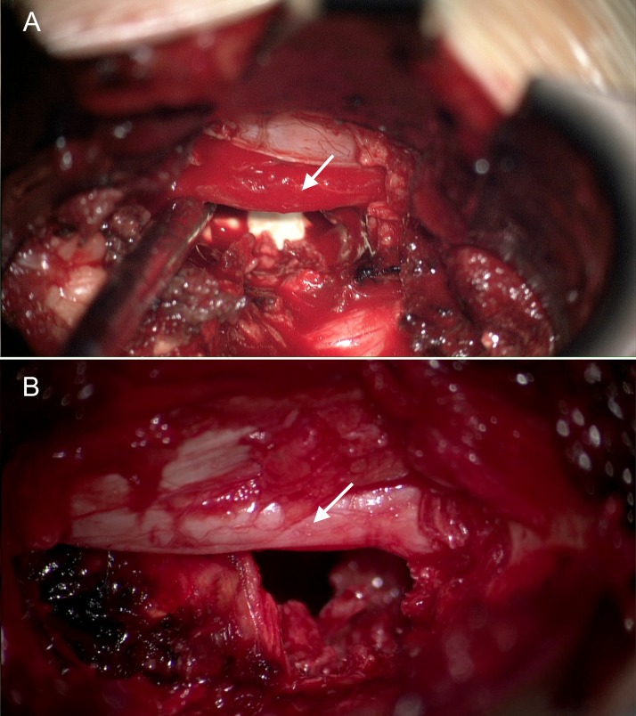 Fig 14