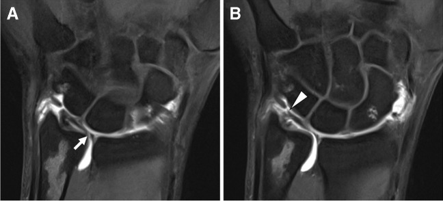 Fig. 16