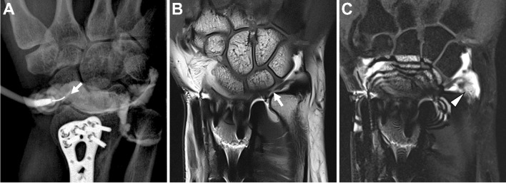 Fig. 17