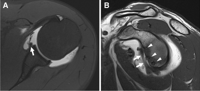 Fig. 12