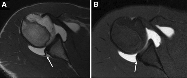 Fig. 11