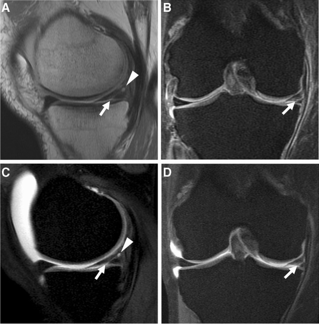 Fig. 21