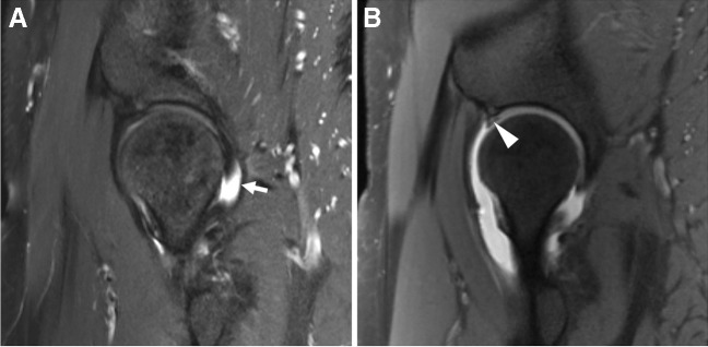 Fig. 18