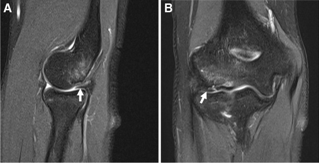 Fig. 14